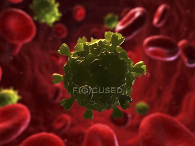 Infektion mit humanen Immunschwächeviren — Stockfoto