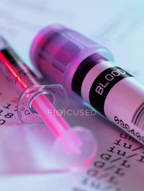 Close-up de amostra de sangue em tubo e seringa
. — Fotografia de Stock