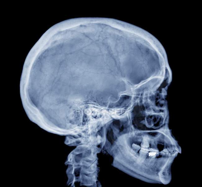 Structure crânienne normale de l'adulte — Photo de stock
