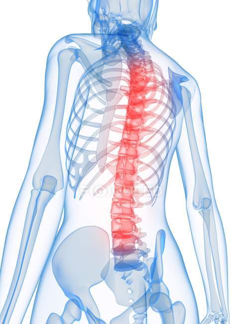 Localización del dolor de espalda - foto de stock