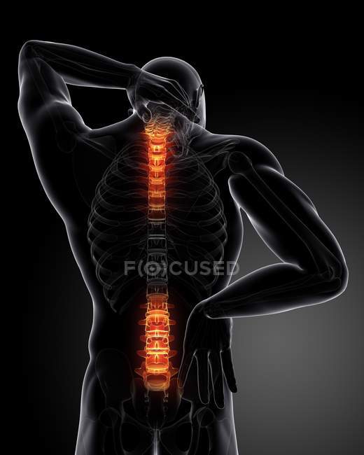 Visualização de dor nas costas — Fotografia de Stock