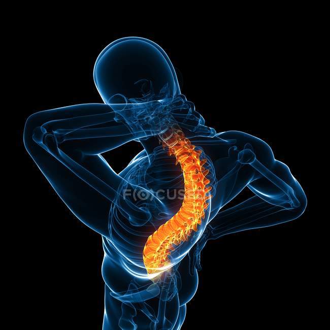 Localização da dor nas costas — Fotografia de Stock