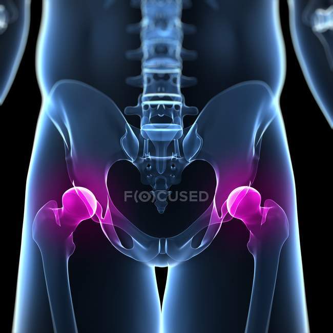 Painful sensation in hip joint — Stock Photo