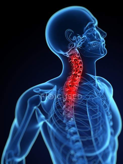 Neck pain affecting cervical vertebrae — Stock Photo