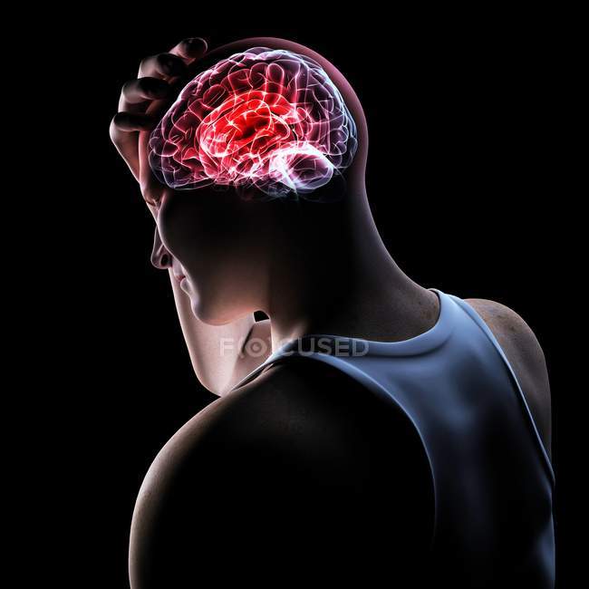 Dolor de cabeza localizado en regiones más profundas del cerebro - foto de stock