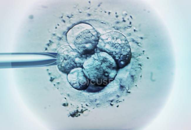 Выбор эмбриона для ЭКО — стоковое фото