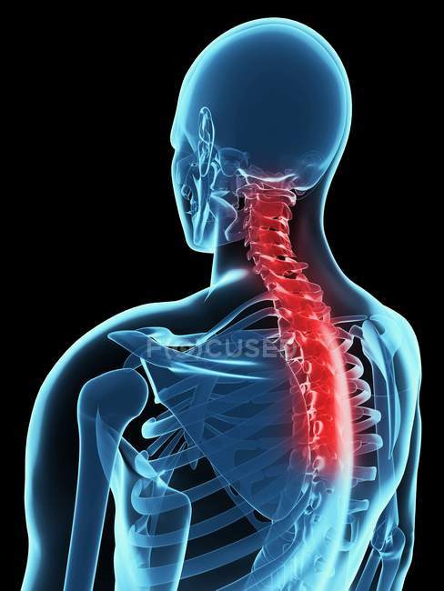 Localizzazione del mal di schiena nella sezione spinale — Foto stock