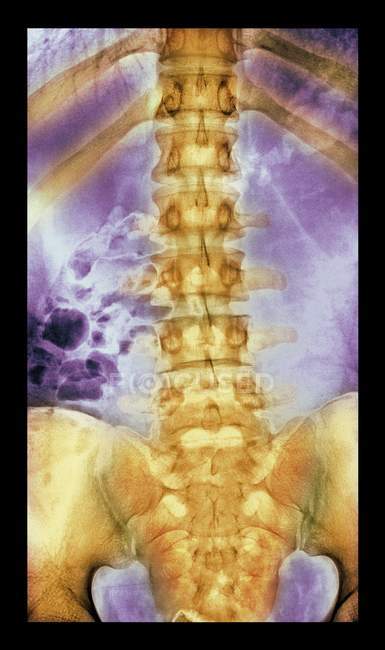 Colonna vertebrale normale e sana — Foto stock