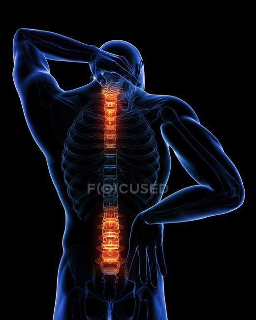 Lokalisierung von Rückenschmerzen im Rückenbereich — Stockfoto