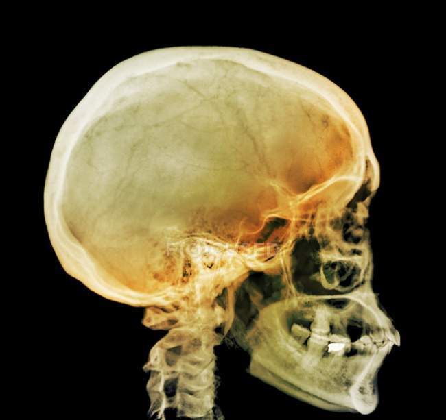 Structure normale du crâne du jeune adulte — Photo de stock