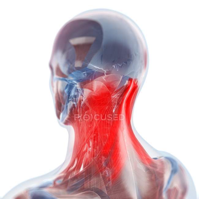 Visualización del dolor en el cuello - foto de stock