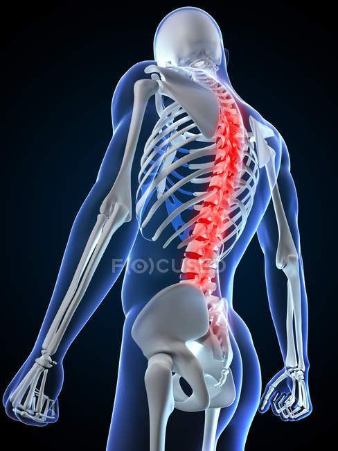 Douleur dans la section thoracique de la colonne vertébrale — Photo de stock