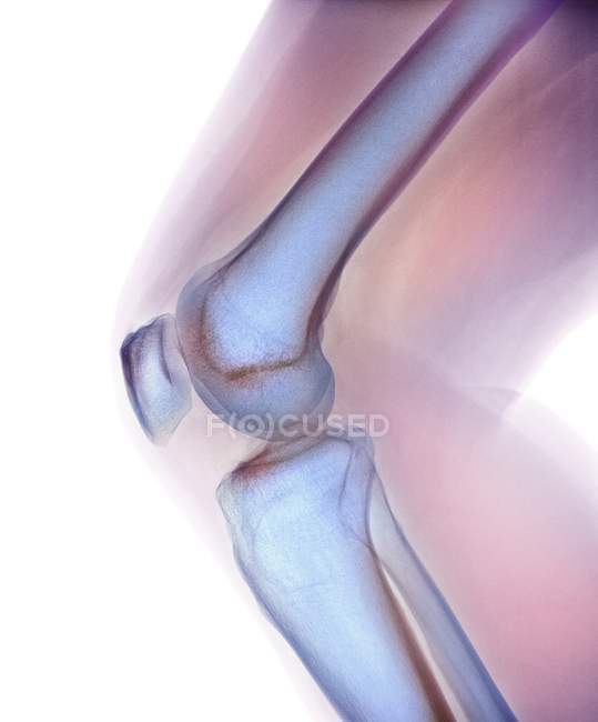 Анатомія коліна здорової зрілої жінки — стокове фото