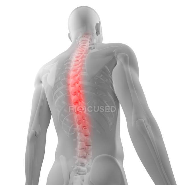 Боли в спине, локализованные в позвоночнике — стоковое фото