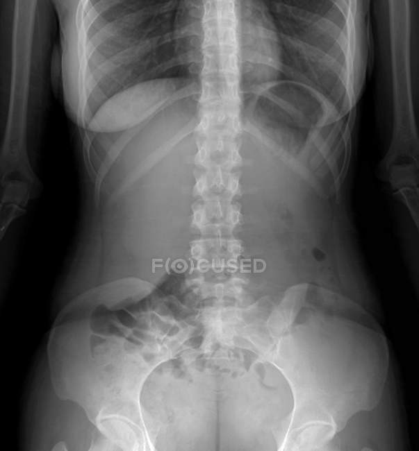 Normal and healthy abdomen anatomy — Stock Photo