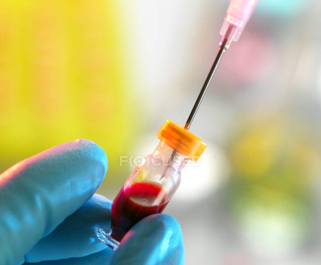 Researcher extracting blood from a vial — Stock Photo