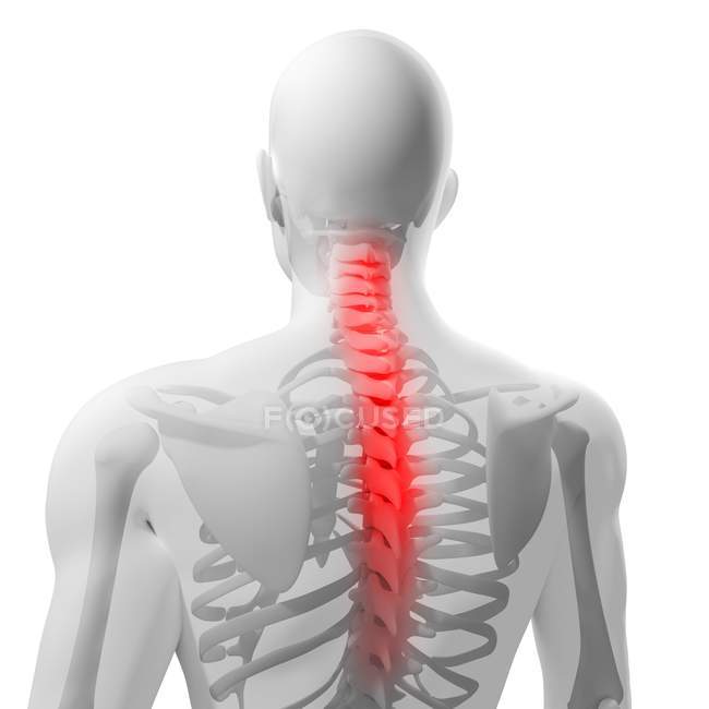 Dor nas costas localizada na coluna vertebral — Fotografia de Stock