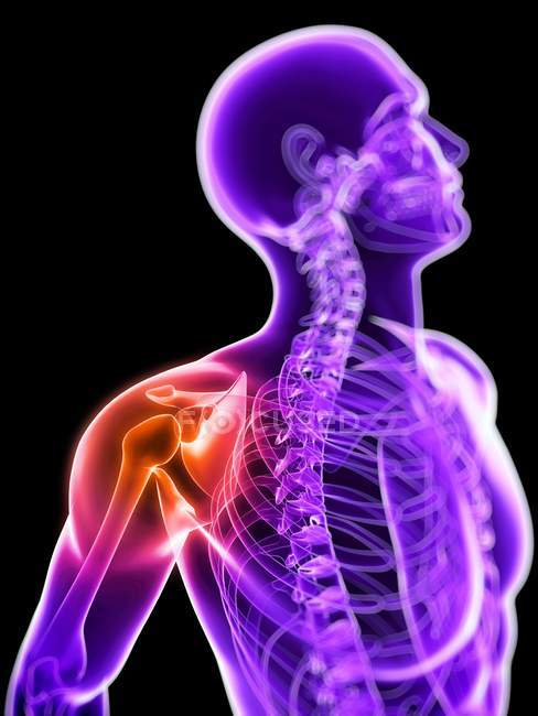 Локализация боли в плечевом суставе — стоковое фото