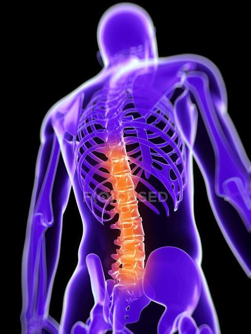 Dor na secção torácica da coluna vertebral — Fotografia de Stock