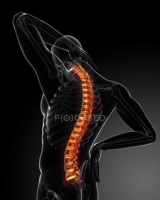 Localisation des maux de dos dans la colonne vertébrale — Photo de stock