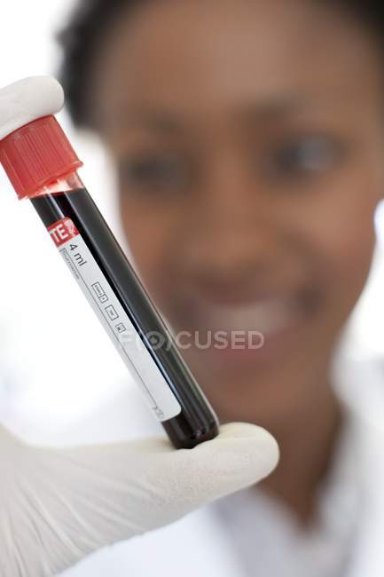 Muestra de sangre en tubo de ensayo en la mano del científico . - foto de stock