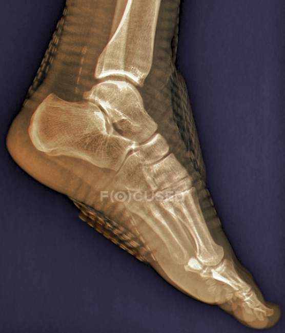 Articulação saudável do tornozelo — Fotografia de Stock