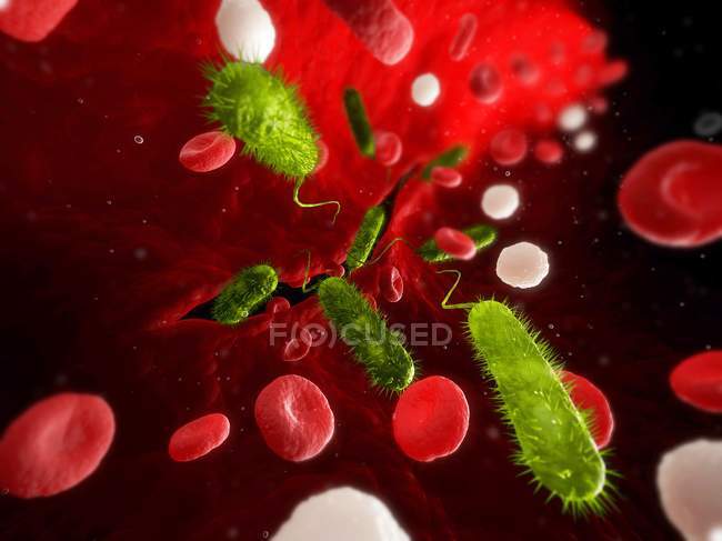 Infección bacteriana en el torrente sanguíneo - foto de stock
