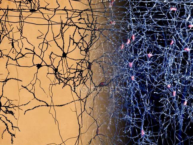 Réseau neuronal dans le cerveau humain — Photo de stock