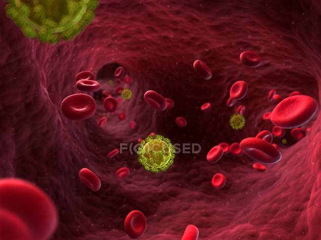 Infección por el virus de inmunodeficiencia en el torrente sanguíneo - foto de stock