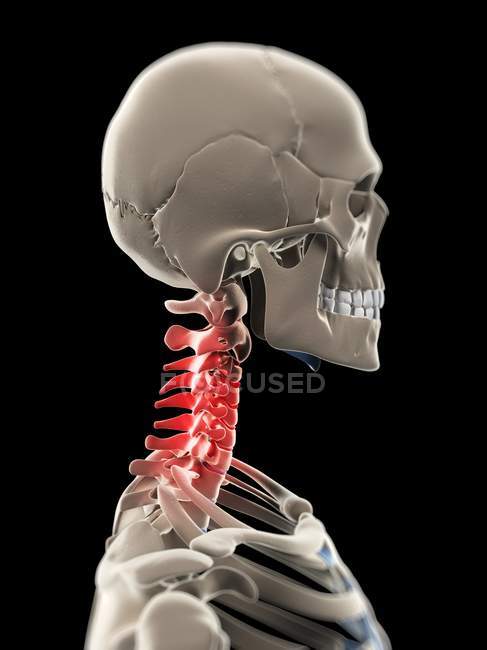 Schmerzen im Halswirbelsäulenbereich lokalisiert — Stockfoto