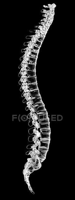Vista lateral de la columna vertebral humana - foto de stock