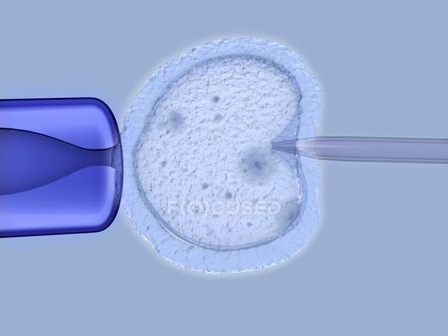 Proceso de fertilización in vitro - foto de stock