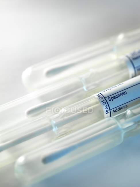 Buccal swabs for obtaining deoxyribonucleic acid samples. — Stock Photo