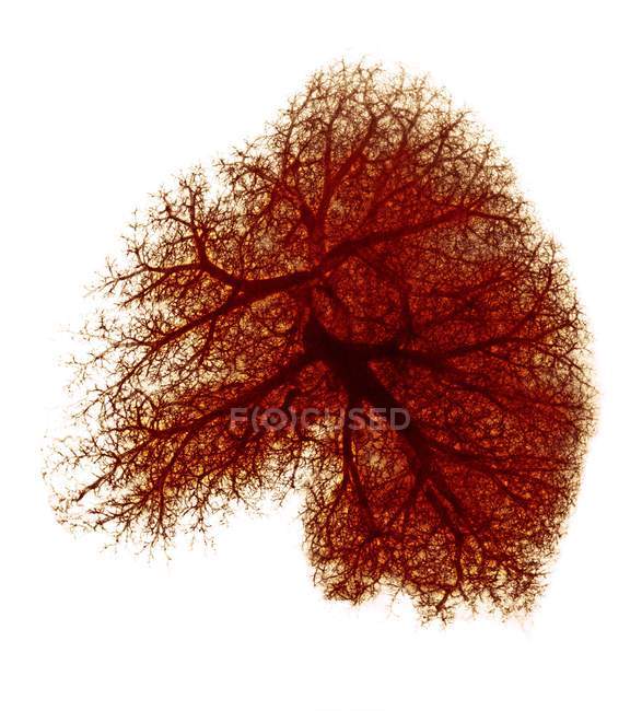 Кольорові рентгенівського показ кровоносних судин в легенів. — стокове фото
