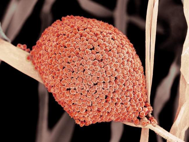Células fúngicas que revelan esporangio con esporas - foto de stock