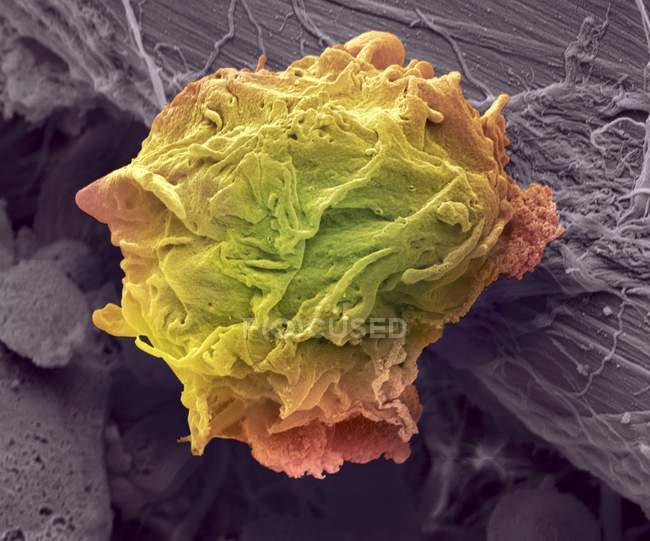 Lymphoma cancer cell — Stock Photo