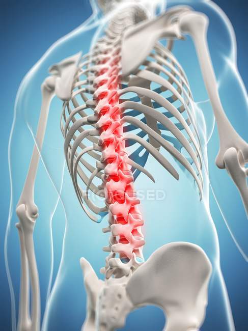 Pain localisation in thoracic section — Stock Photo