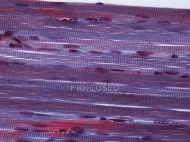 Skeletal muscle fibres — Stock Photo