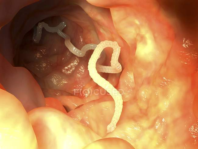 Mature intestinal tapeworm — Stock Photo