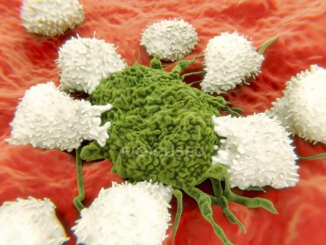 Lymphocytes attacking a cancer cell — Stock Photo