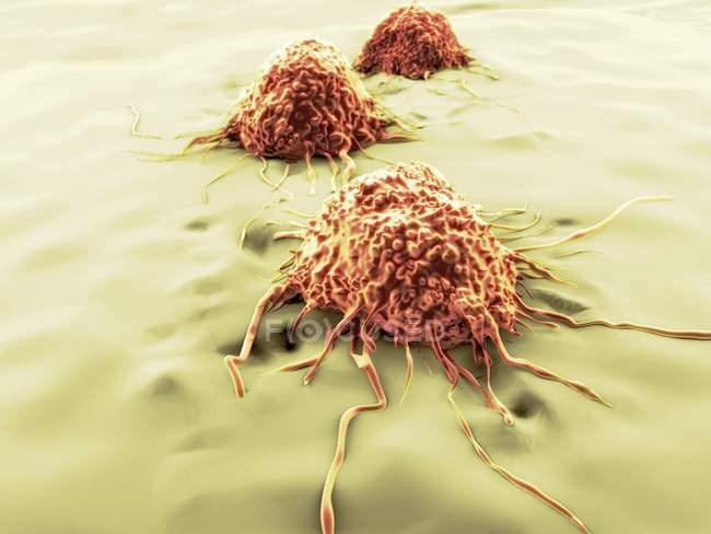 Мигрирующие раковые клетки — стоковое фото