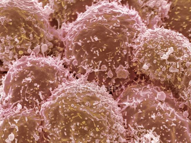 Клітин раку легенів — стокове фото