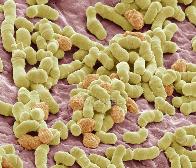Cells of brewer yeast — Stock Photo