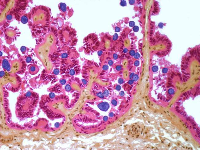 Canal biliaire hépatique infecté par des protozoaires cocidiens — Photo de stock