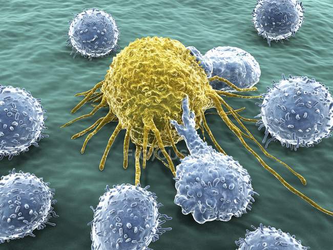 Linfocitos que atacan una célula cancerosa - foto de stock