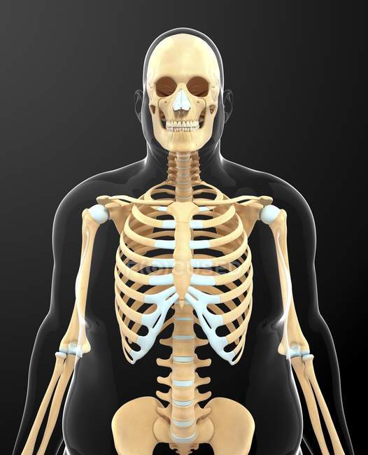 Skeletal system of obese individual — Stock Photo