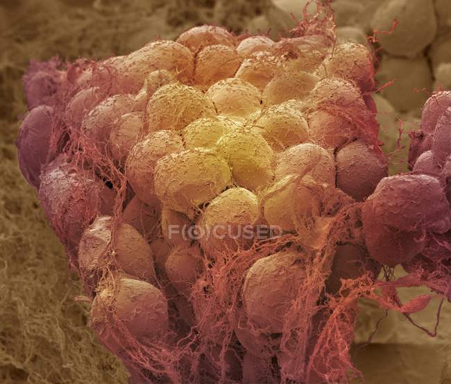 Fat cells and supportive connective tissue — Stock Photo