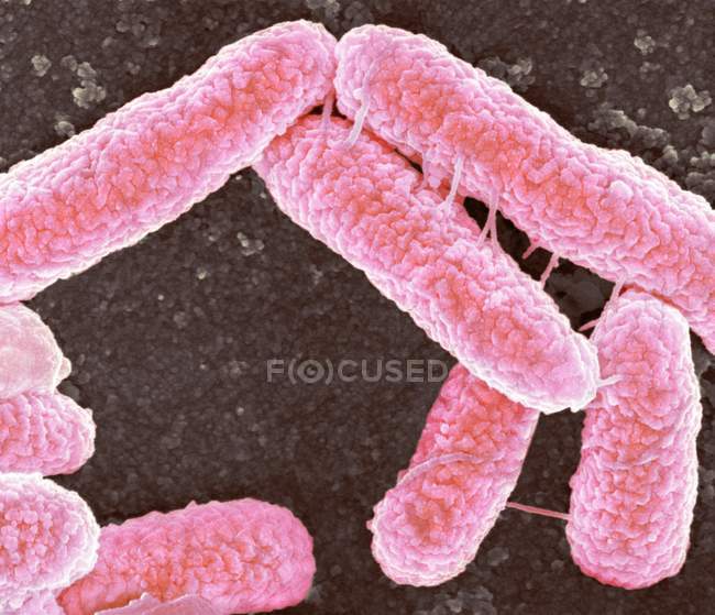 Bactérias Escherichia coli — Fotografia de Stock