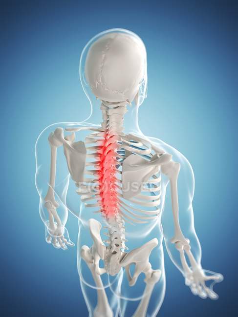 Локализация болей в спине — стоковое фото