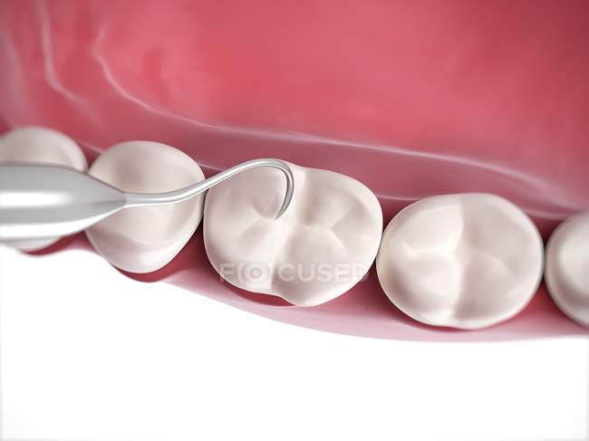 Dentes humanos a serem limpos — Fotografia de Stock